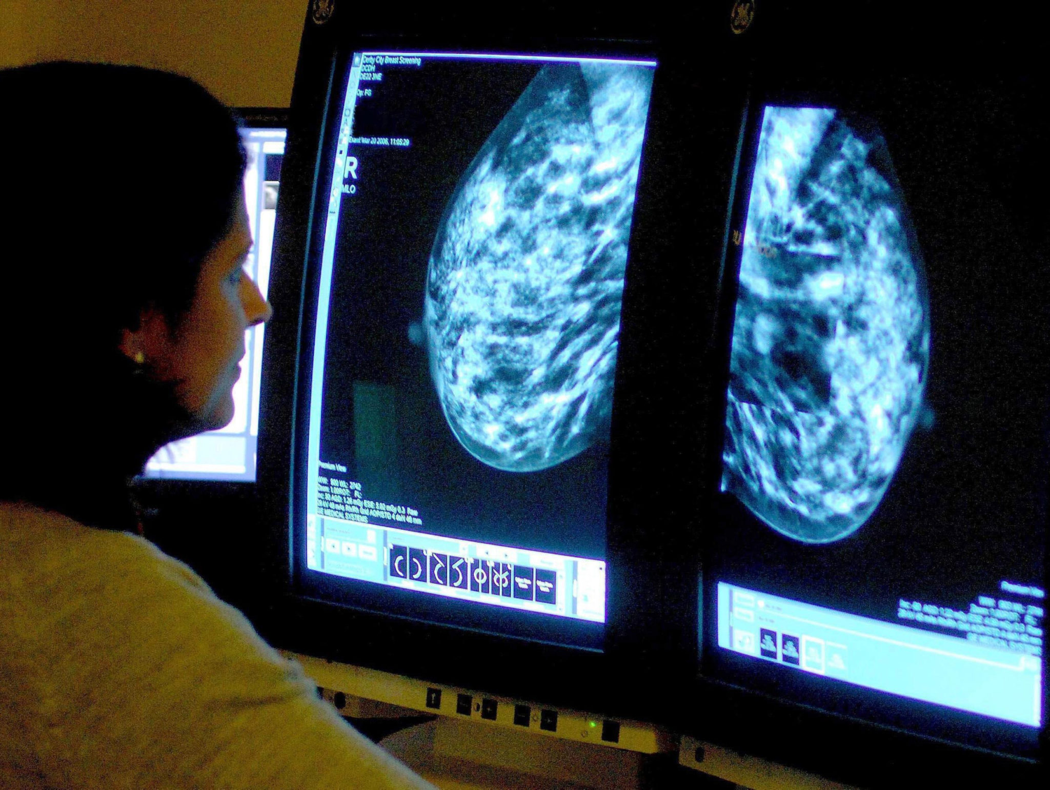 Cancer diagnoses dropped in 2021 due to COVID pandemic - NCRI Report - Vimarsana News