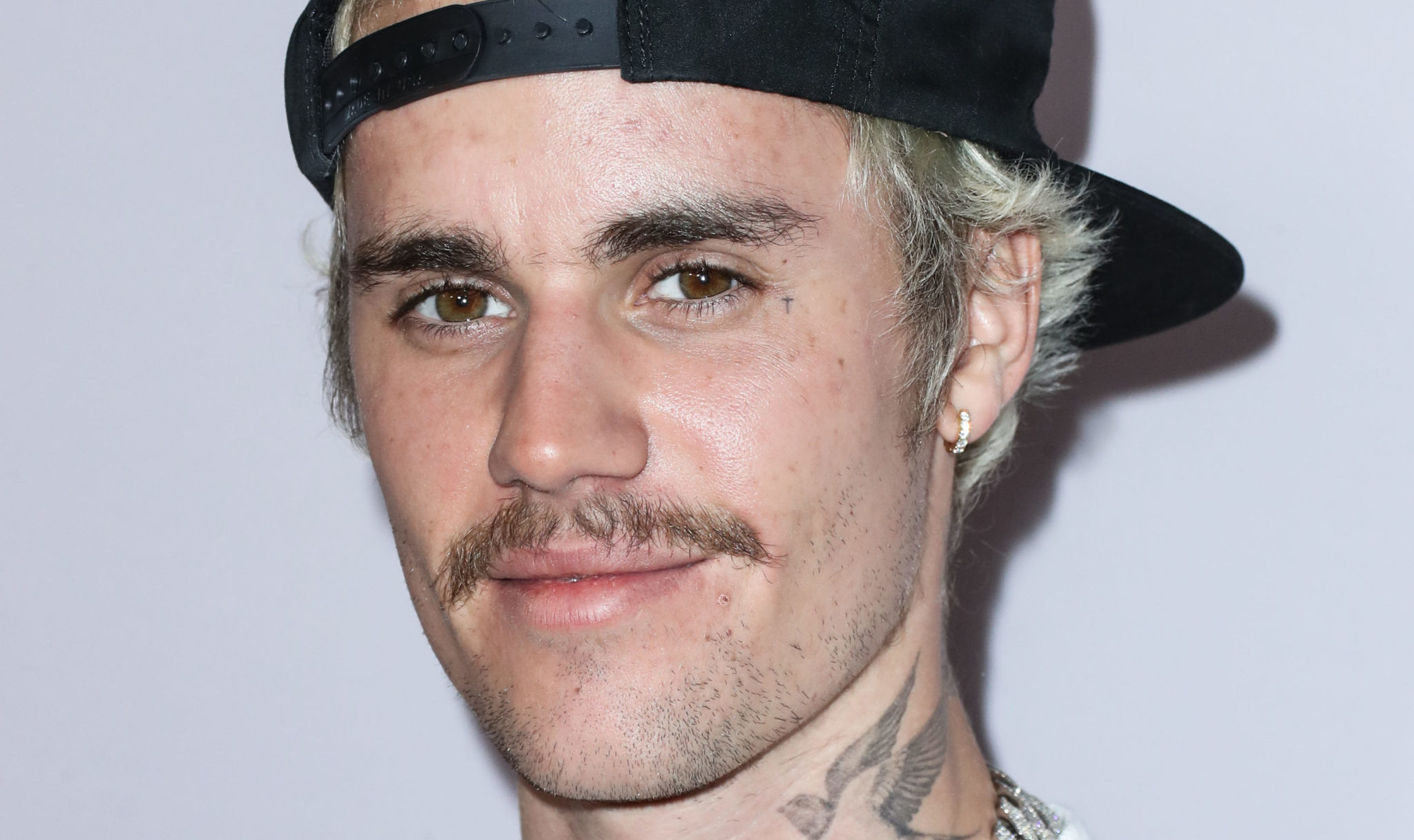 Justin Bieber Reveals He S Suffering From Rare Medical Condition SPIN