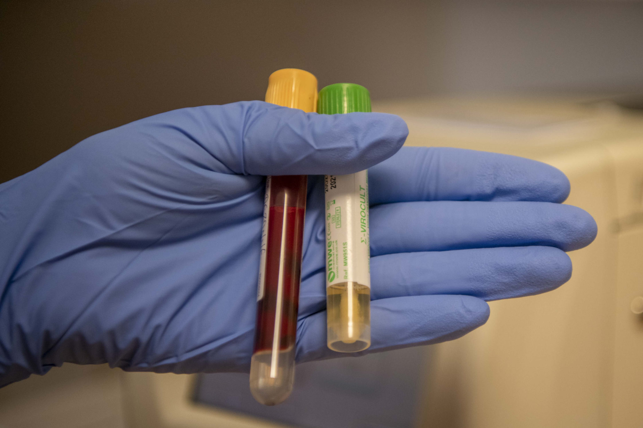 A nurse holding swab and antibody tests