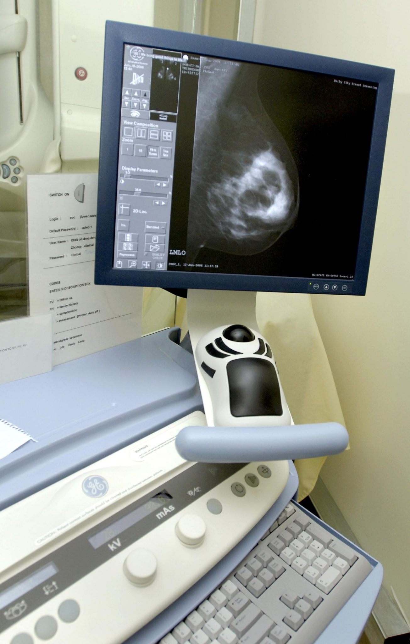 Cork breast cancer patient calling for breast screening age to be