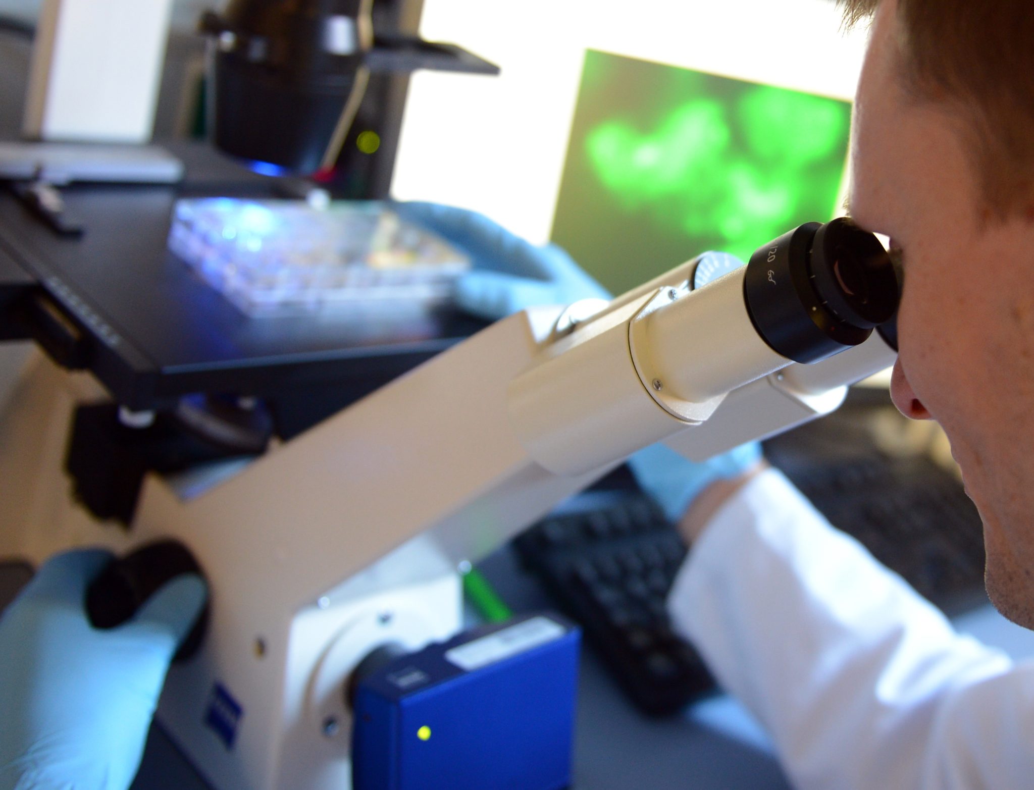 Ireland's cancer rate 26% higher than EU average in 2020 - Vimarsana News