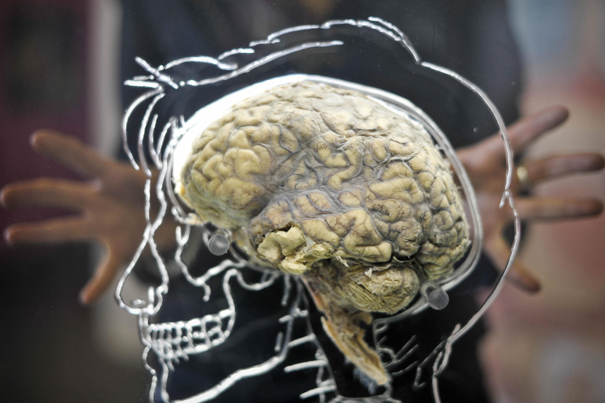 A Thousand Brains Image