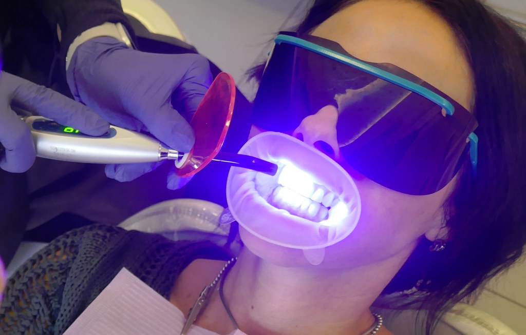 Teeth whitening at a dentist in Toronto
