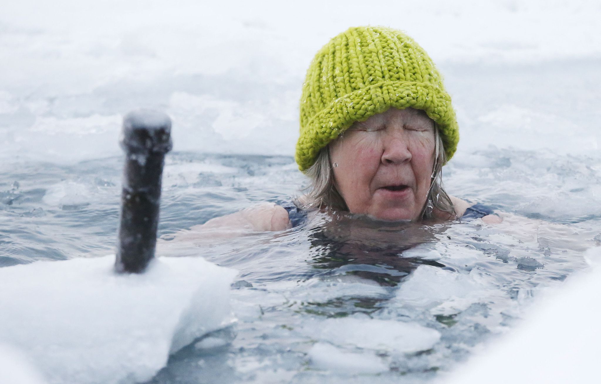 The Science and History of Hypothermia Image