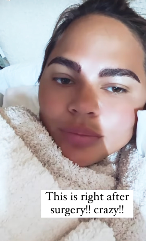 Chrissy Teigen after her eyebrow transplant