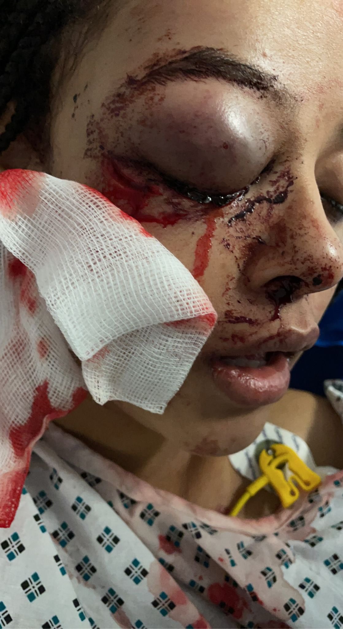Alanna Quinn Idris was seriously injured in the assault