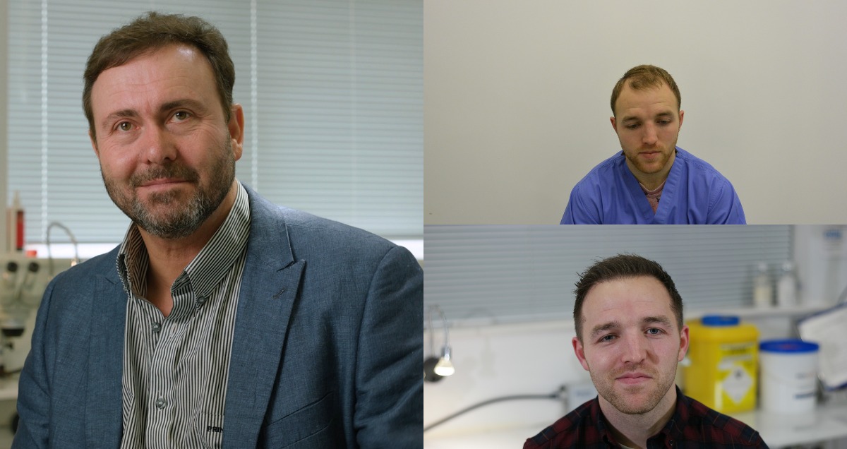 Everything You Need To Know About Hair Restoration Image