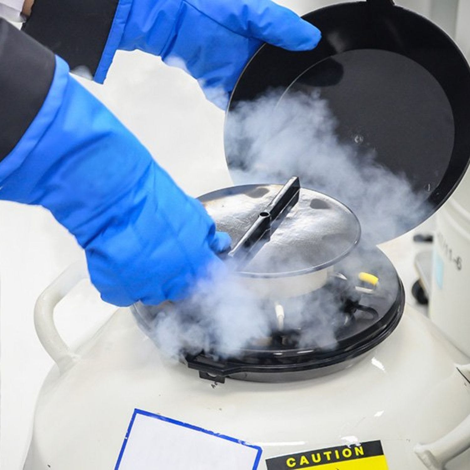 Egg freezing 'getting more and more common' in Ireland - Vimarsana News