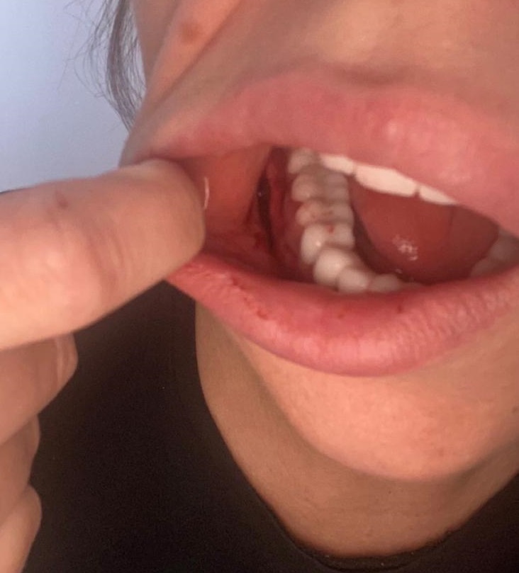 Amanda's dental work