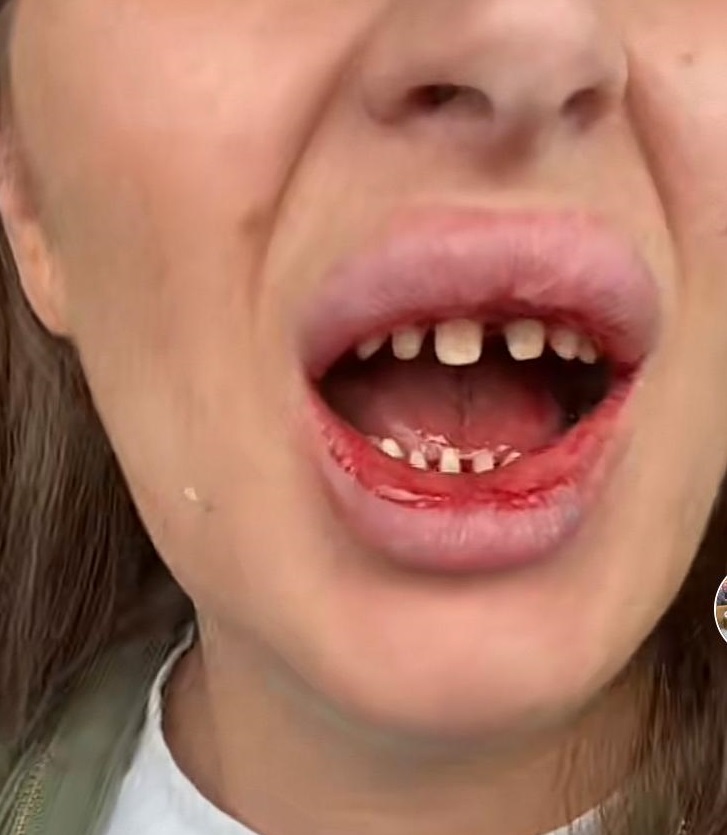Amanda's dental work.