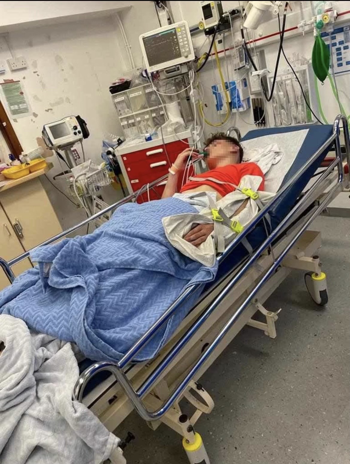 The young boy in ICU after the brutal assault in Bushy Park in Dublin.