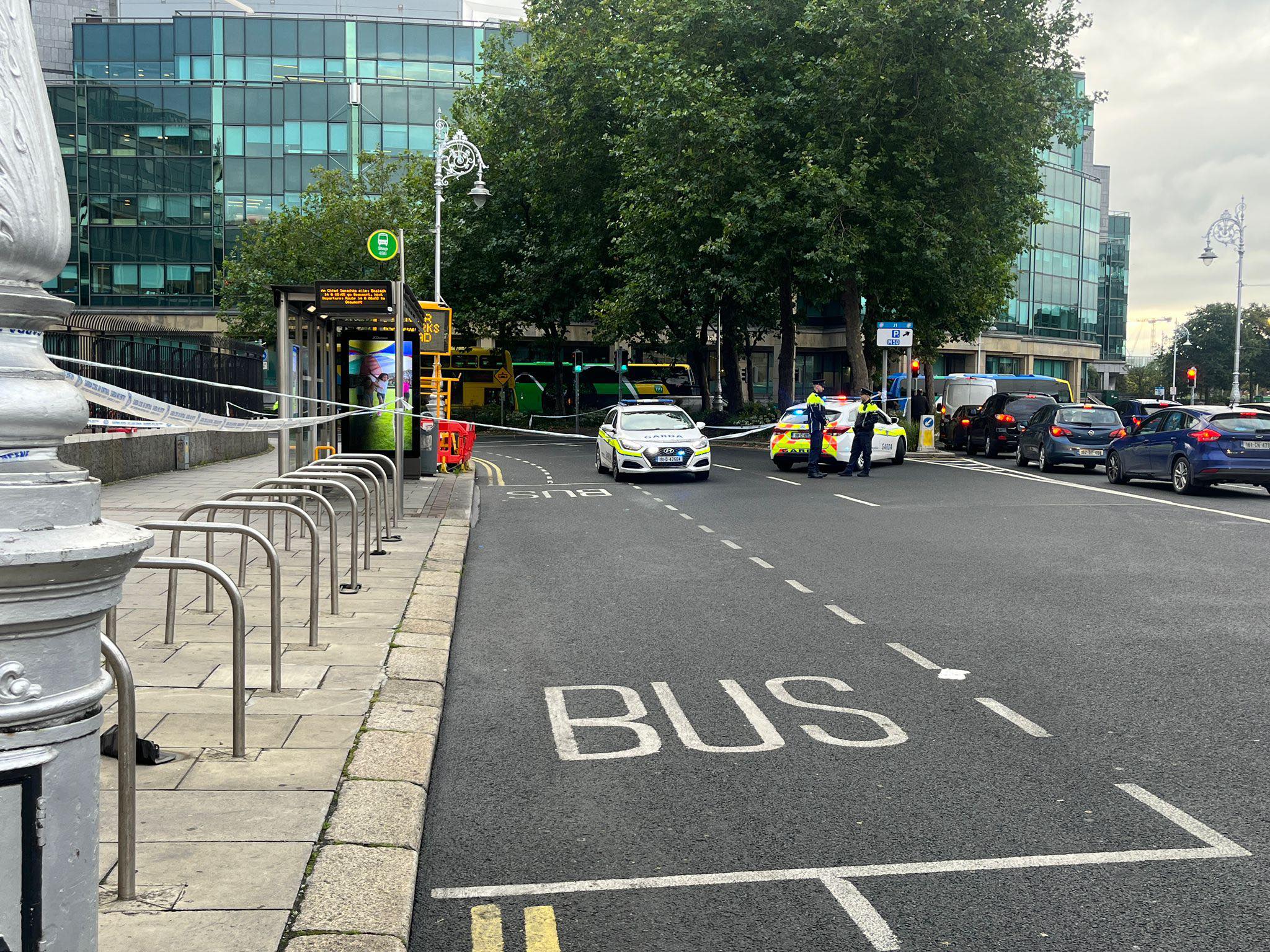 Man dies after being hit by bus in Dublin - Vimarsana News