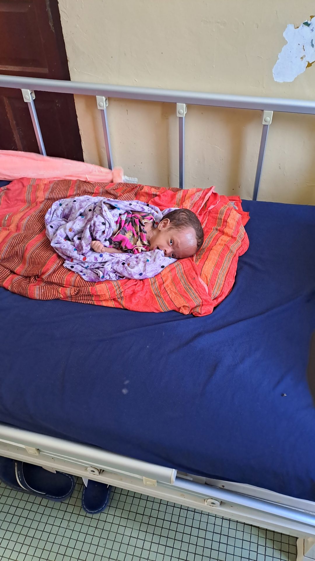 A baby at Banadir Hospital in Mogadishu, Somalia