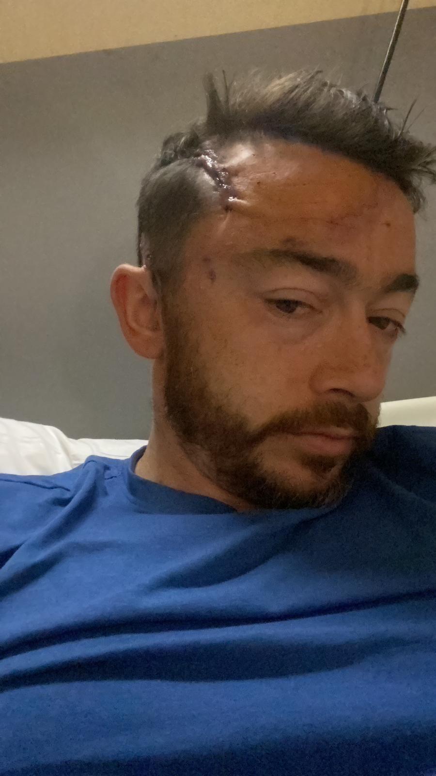 Tony is seen after surgery