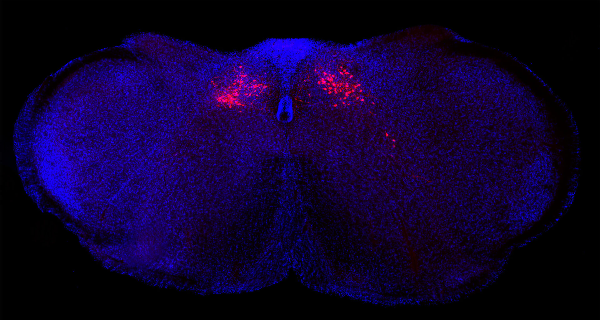 Neurons in the brainstem of a mouse that control body inflammatory responses (labeled in red) and the brain’s other cells (labeled in blue).