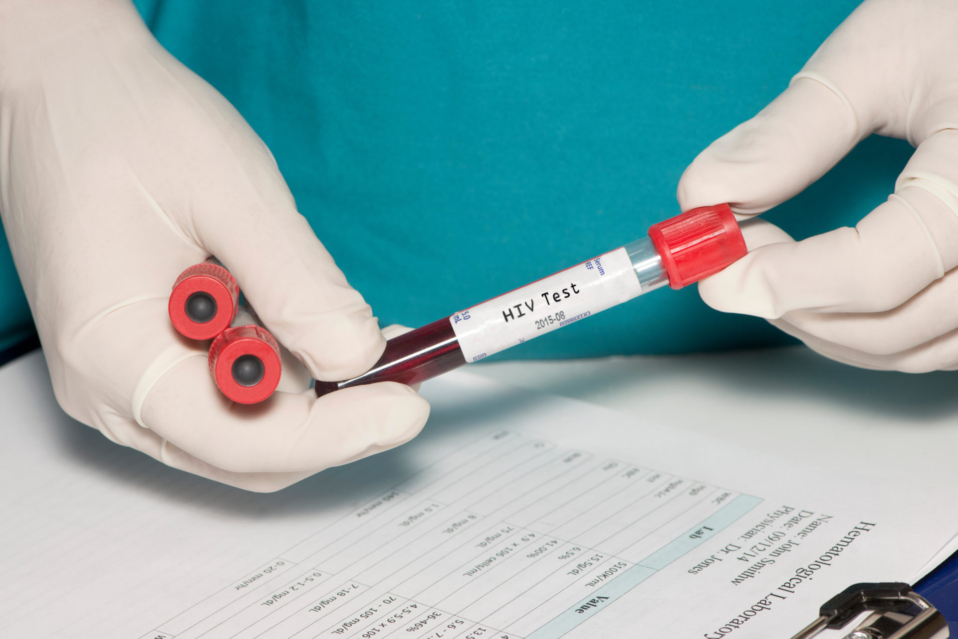 Blood collection tube with HIV test label held by technician.