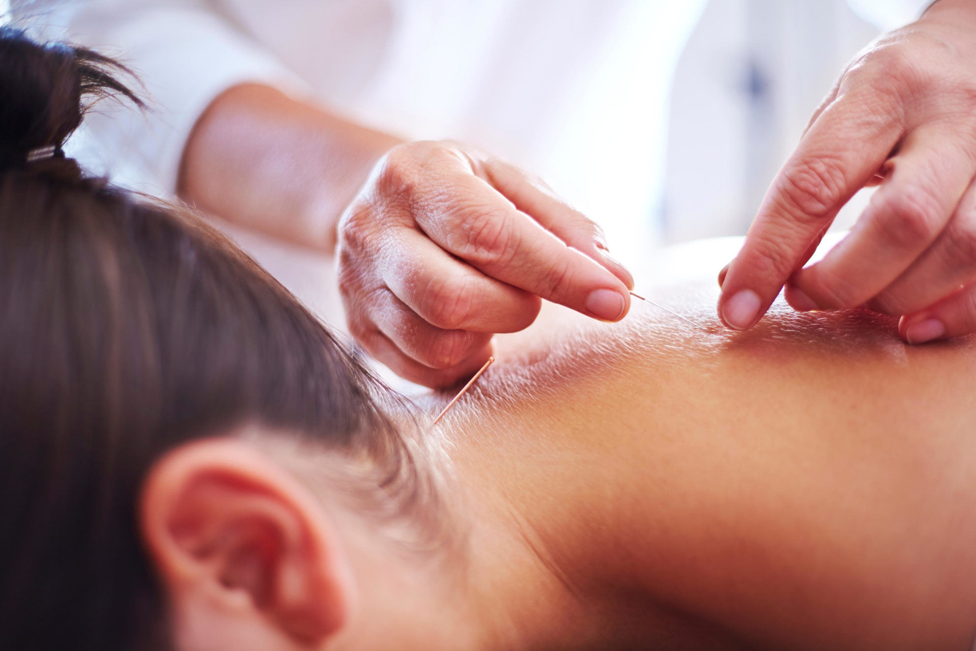 Conception: Why acupuncture can have 'transformative' impact