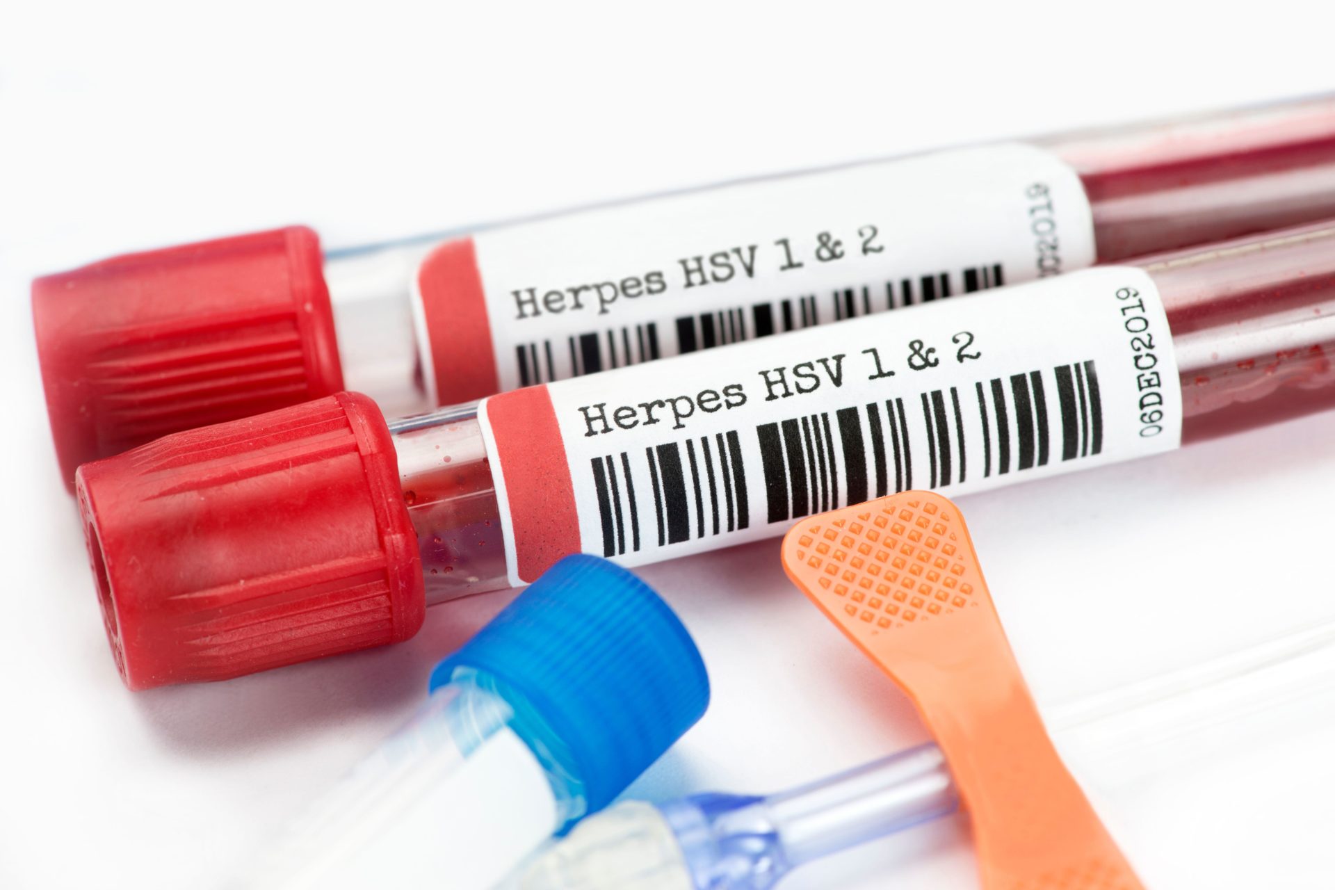 Herpes blood testing can determine the presence of Herpes virus antibodies in blood plasma. 