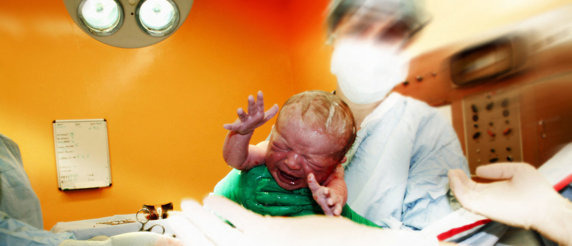 Obesity and older mothers behind Ireland's high rate of c-section births