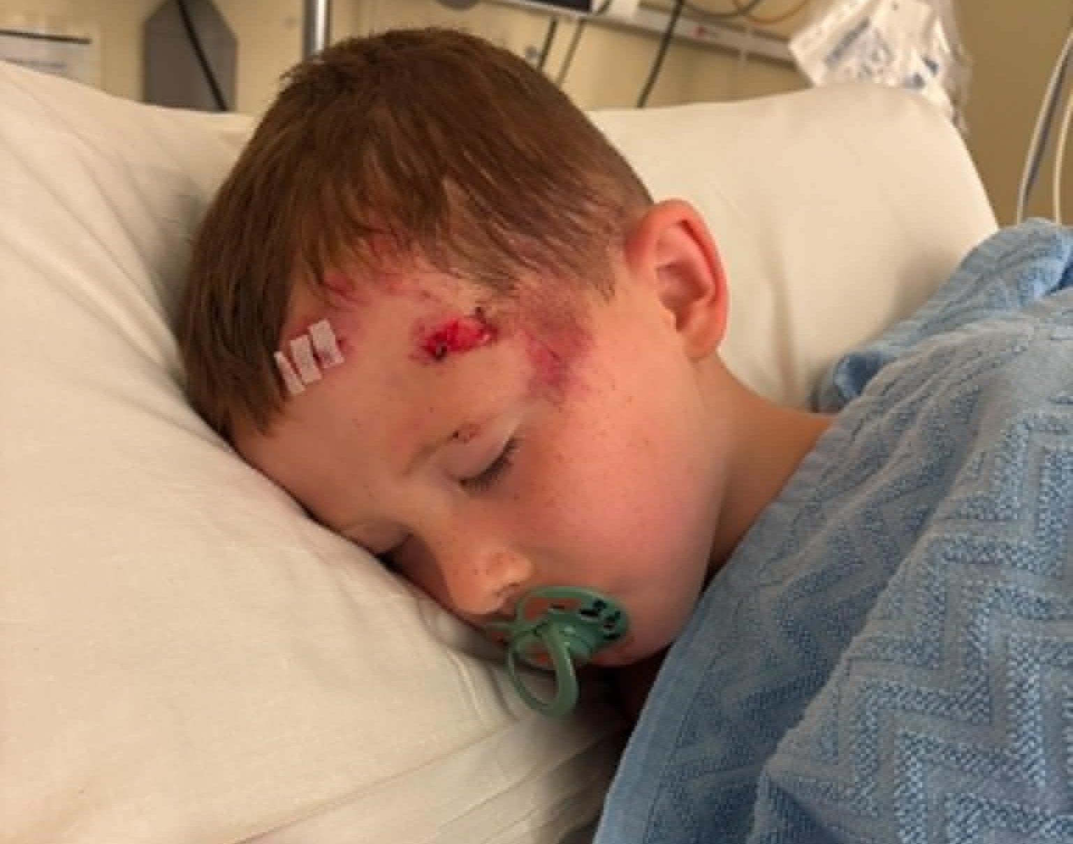 Mother of injured child calls for e-scooter ban for under 21s